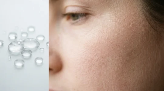 Peau déshydratée et barrière cutanée fragilisée malgré les soins hydratants appliqués